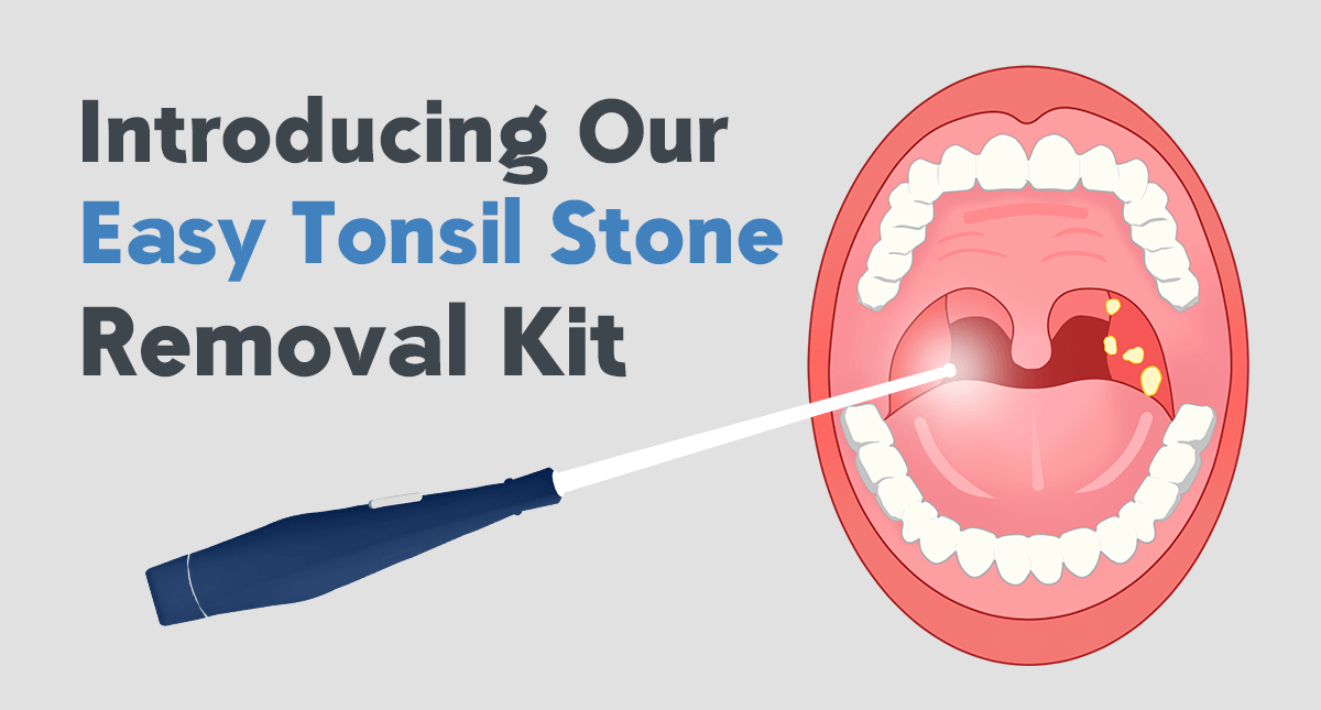 Fight Bad Breath with Our Easy Tonsil Stone Removal Kit