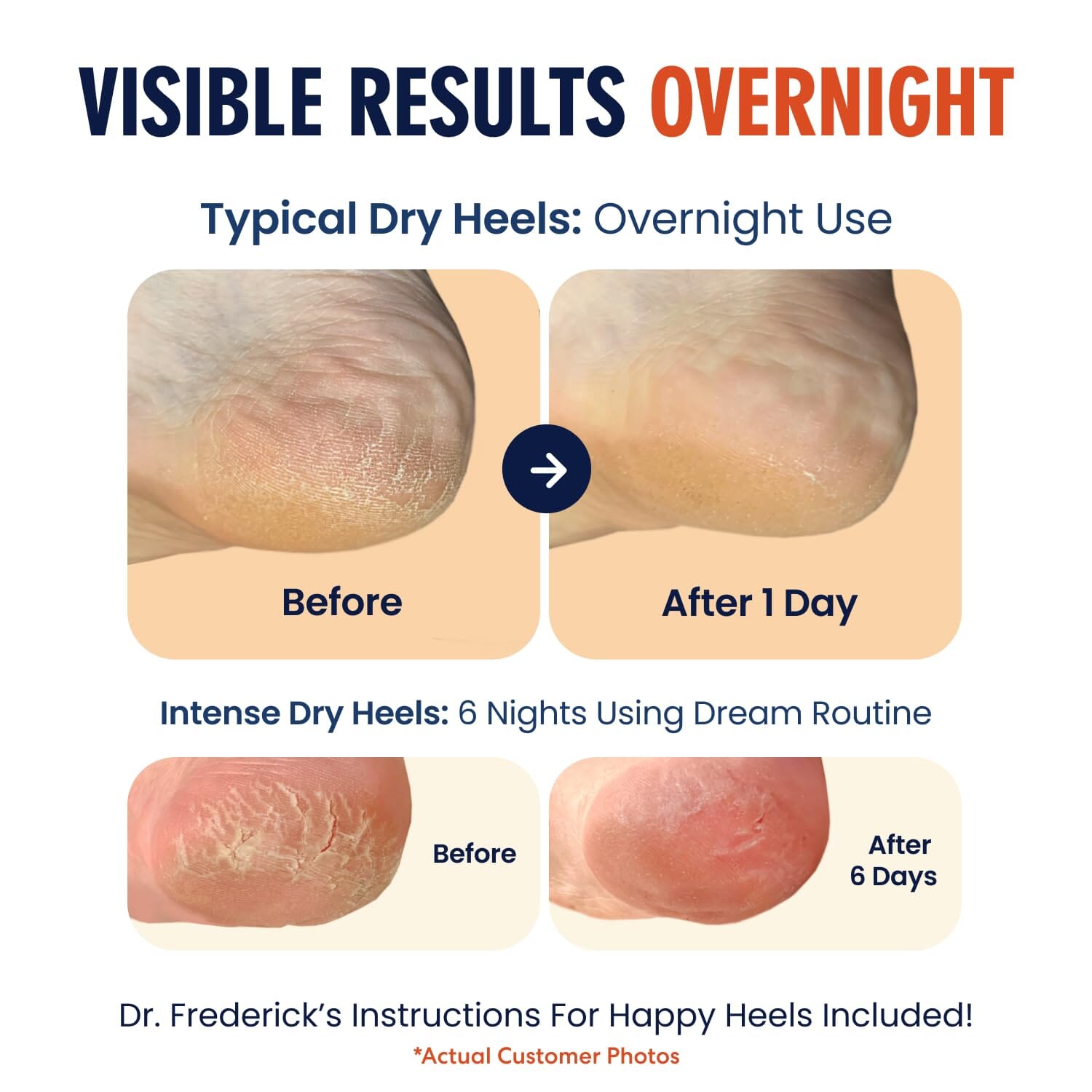 Dr. Frederick's Original Moisturizing Heel Socks for Cracked Heel Treatment - 6 Pairs - Socks for Dry Feet - Cracked Skin Repair & Overnight Hydration - Foot Care for Women & Men - Power Pack Cracked Heel Dr. Frederick's Original