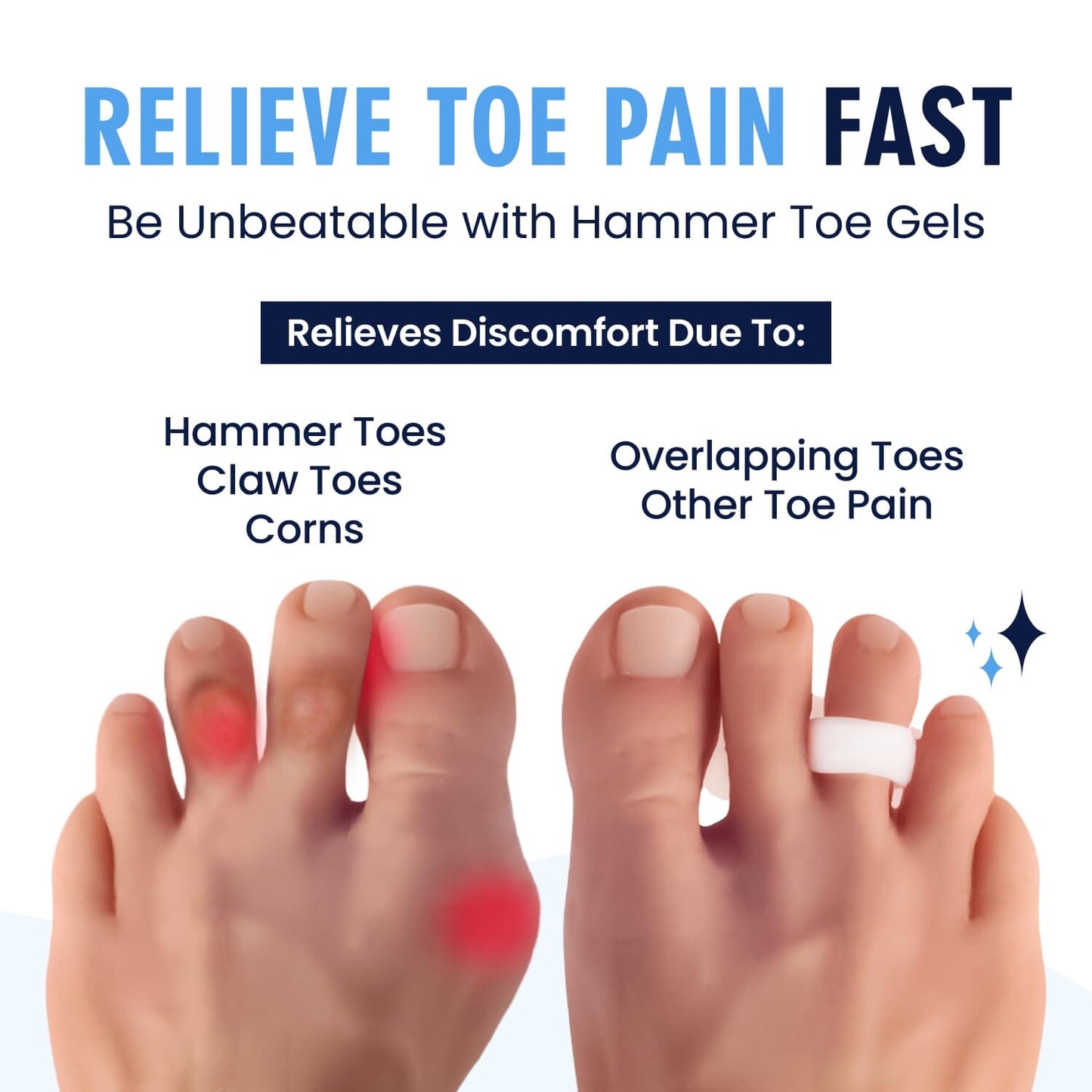 Dr. Frederick's Original Hammer Toe Gels - 2 Pairs - Hammertoe Support Crest for Women & Men - Cushion & Temporary Splint for Toe Alignment, Crooked Toes, and Pain Relief - White - 1 Loop Design Foot Pain Dr. Frederick's Original