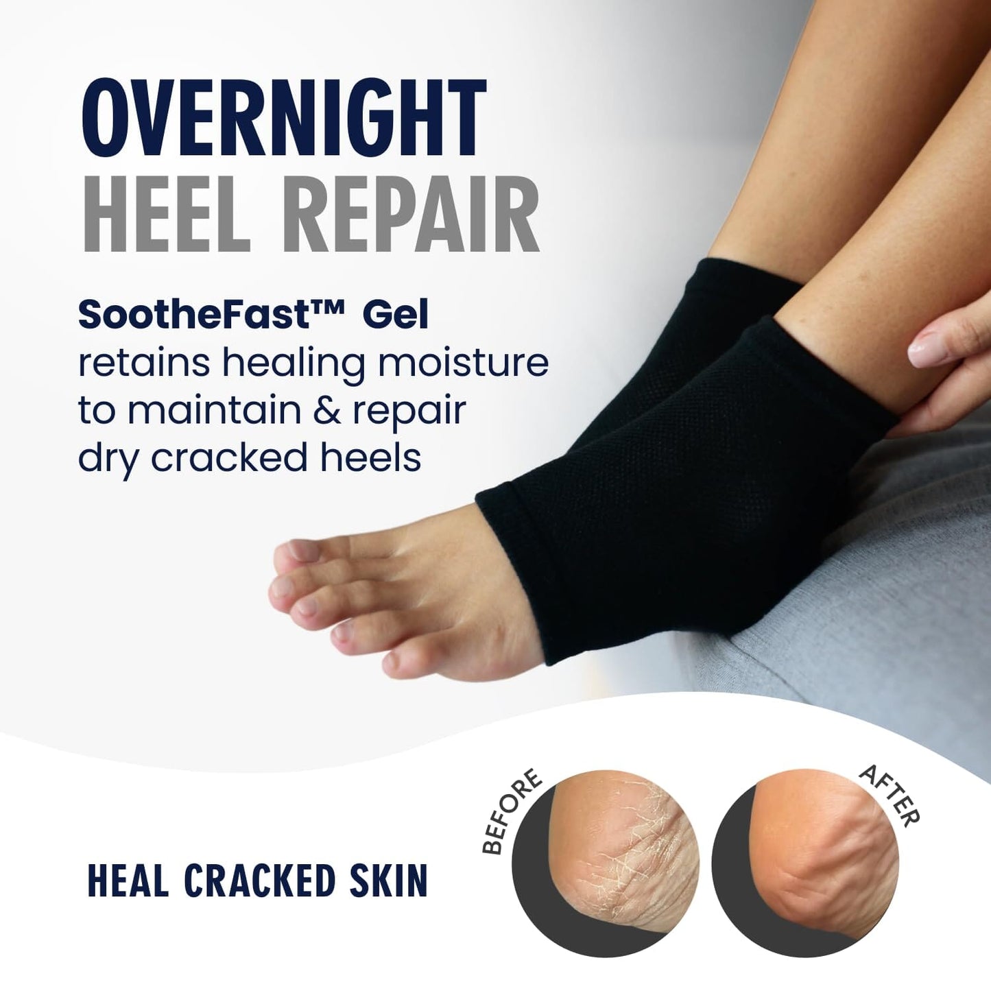 Dr. Frederick's Original Moisturizing Heel Socks for Cracked Heel Treatment - 2 Pairs - Stop Cracked Heels in Their Tracks