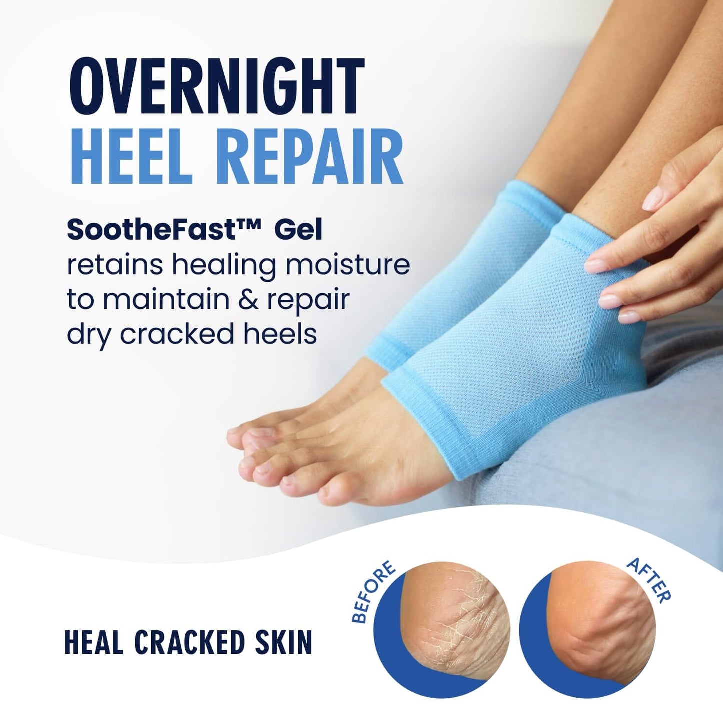Dr. Frederick's Original Moisturizing Heel Socks for Cracked Heel Treatment - 2 Pairs - Stop Cracked Heels in Their Tracks