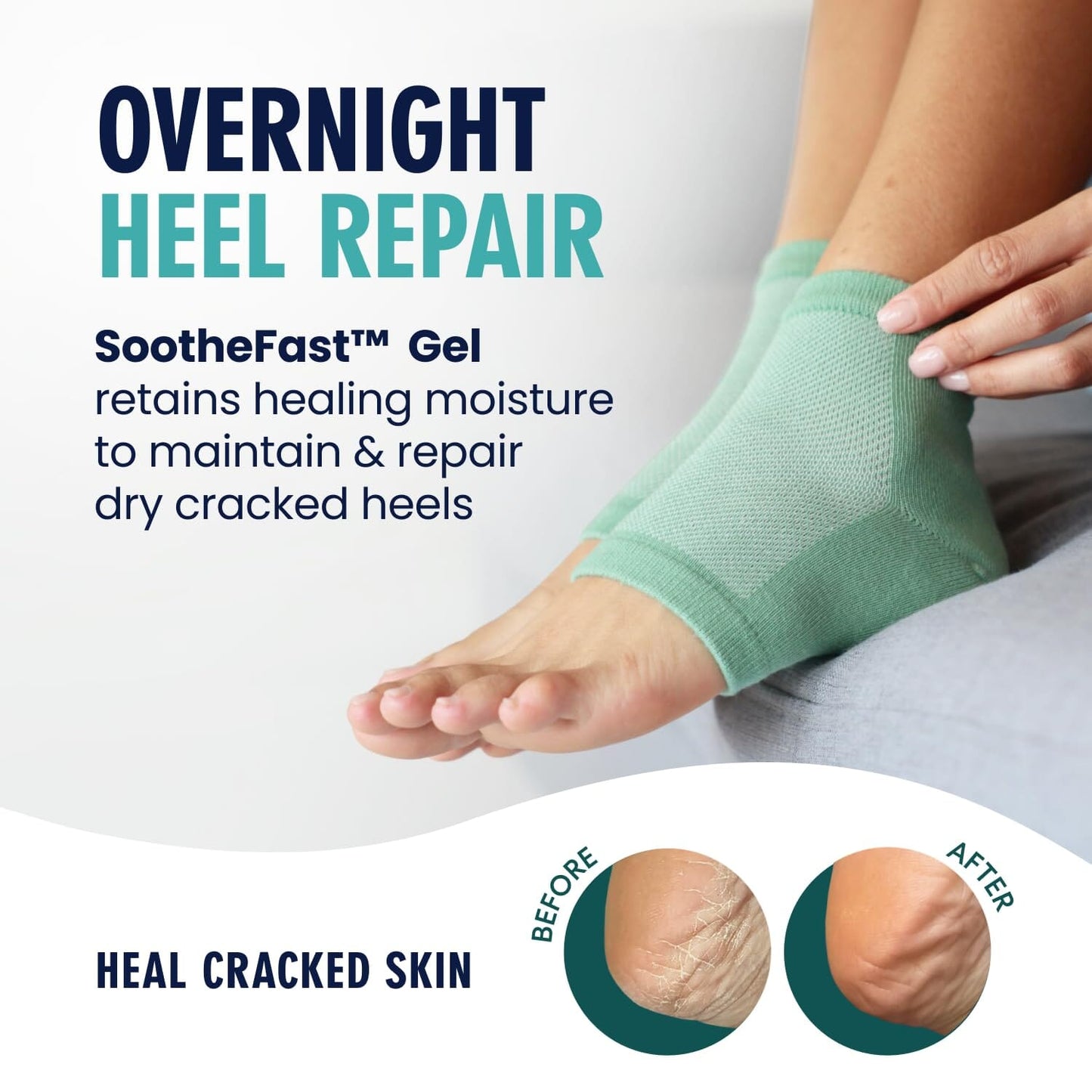 Dr. Frederick's Original Moisturizing Heel Socks for Cracked Heel Treatment - 2 Pairs - Stop Cracked Heels in Their Tracks