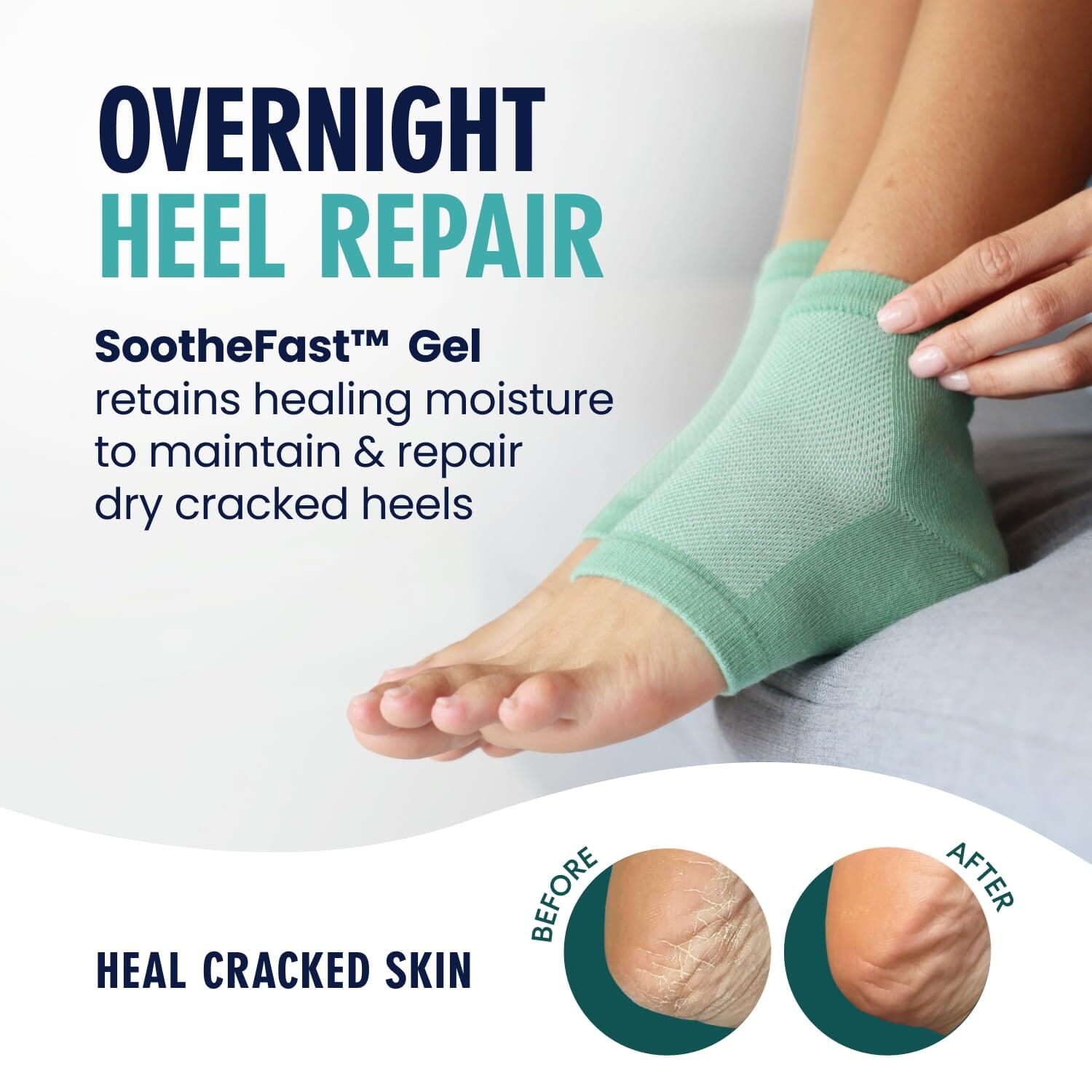 Dr. Frederick's Original Moisturizing Heel Socks for Cracked Heel Treatment - 2 Pairs - Stop Cracked Heels in Their Tracks Cracked Heel Dr. Frederick's Original