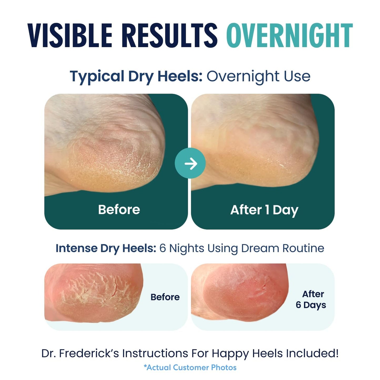 Dr. Frederick's Original Moisturizing Heel Socks for Cracked Heel Treatment - 2 Pairs - Stop Cracked Heels in Their Tracks