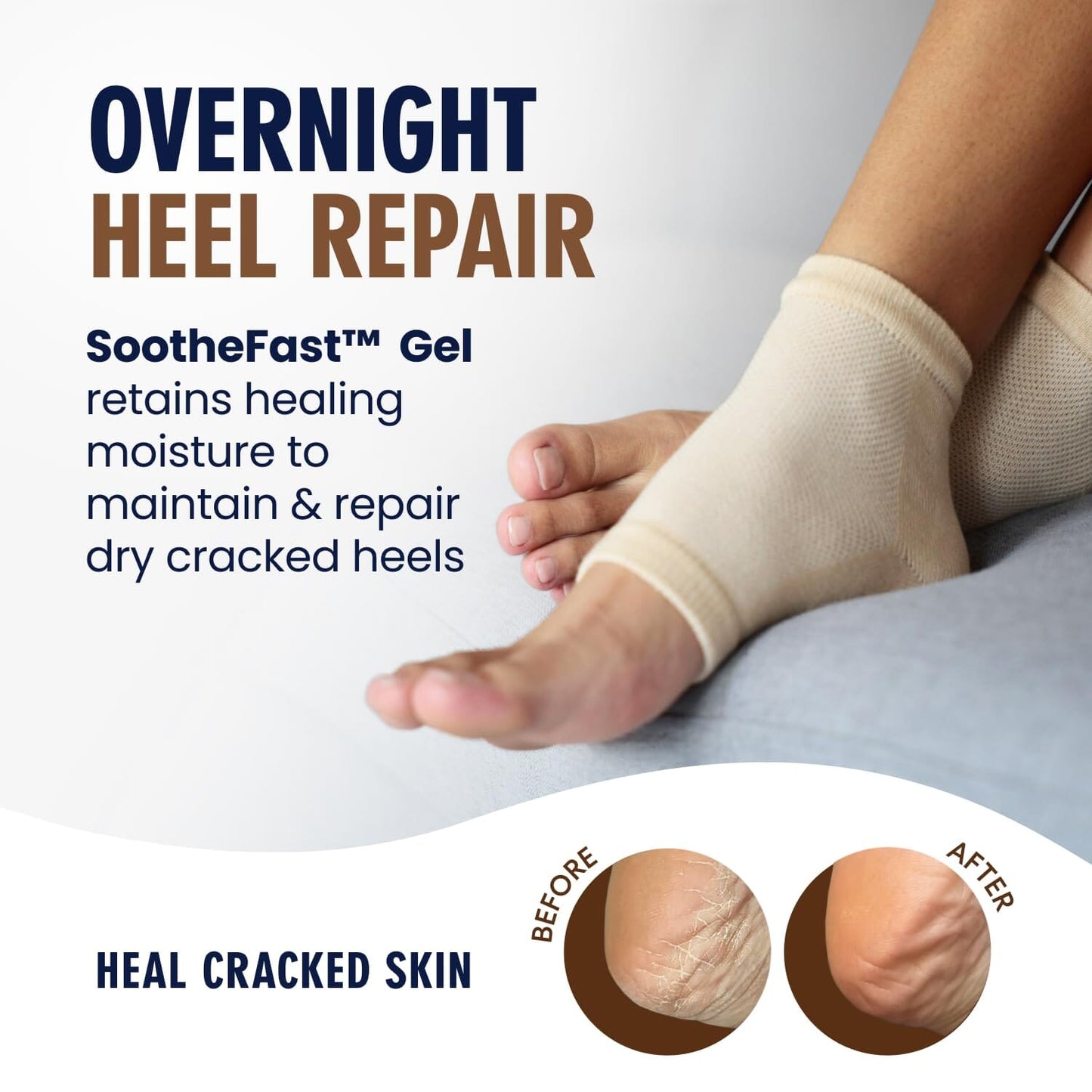 Dr. Frederick's Original Moisturizing Heel Socks for Cracked Heel Treatment - 2 Pairs - Stop Cracked Heels in Their Tracks