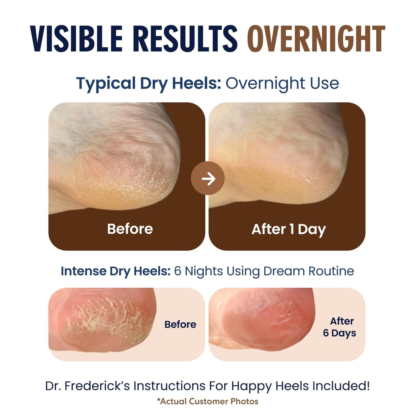 Dr. Frederick's Original Moisturizing Heel Socks for Cracked Heel Treatment - 2 Pairs - Stop Cracked Heels in Their Tracks