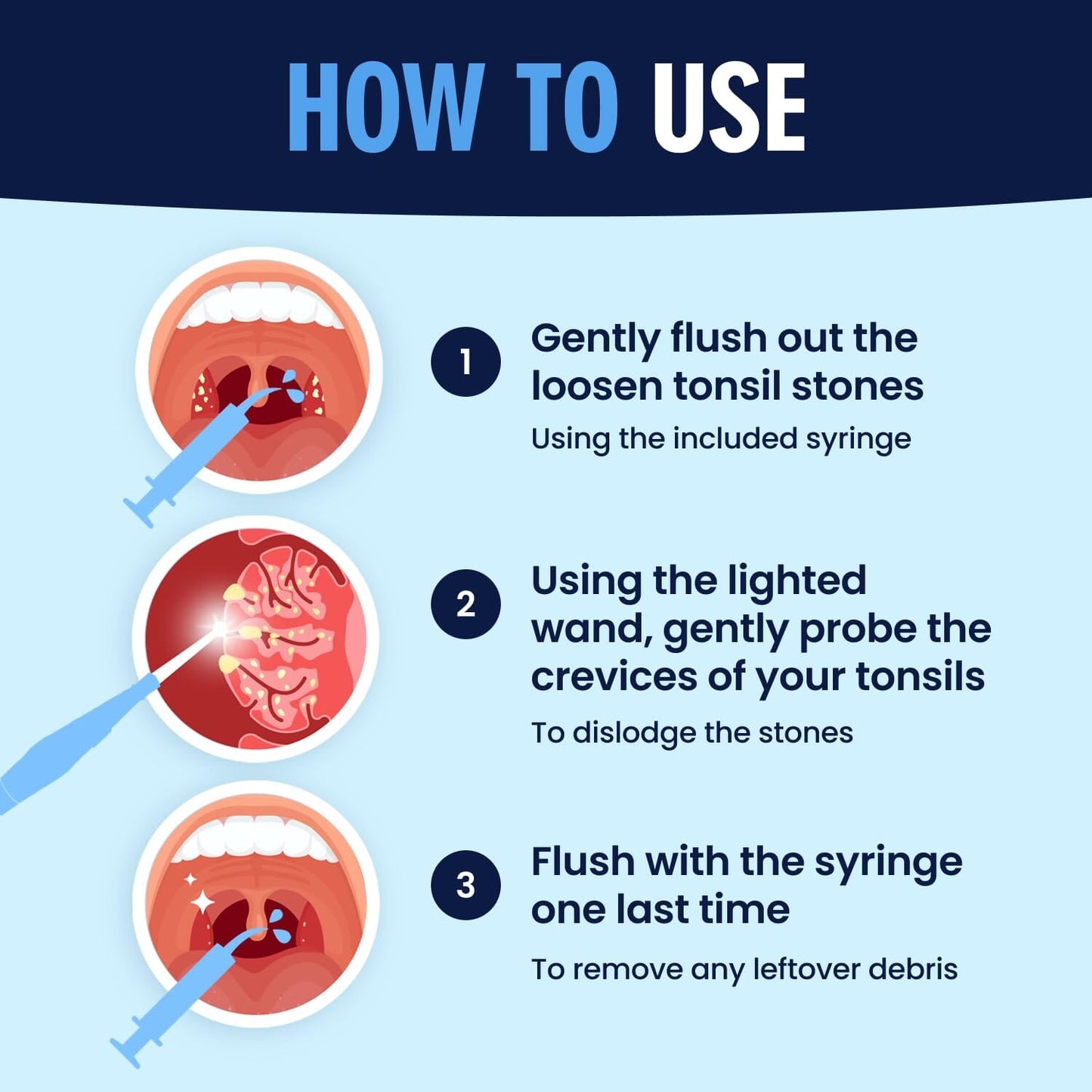 Dr. Frederick's Original Easy Tonsil Stone Remover Kit - Fast Painless Tonsillolith Removal Tool - Fight Bad Breath - Pick and Oral Irrigator - 8 Pieces Dental Care Dr. Frederick's Original