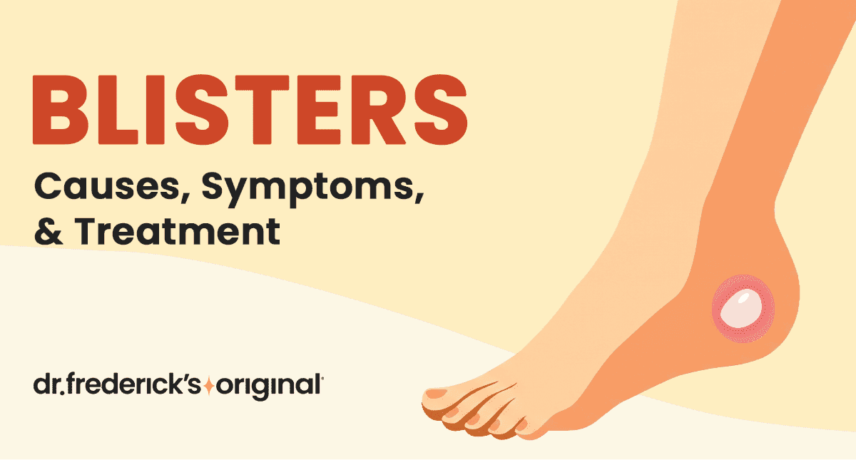 Blisters: Symptoms, Causes, Types and Treatments