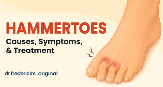 Hammertoes: Symptoms, Causes, and Treatment
