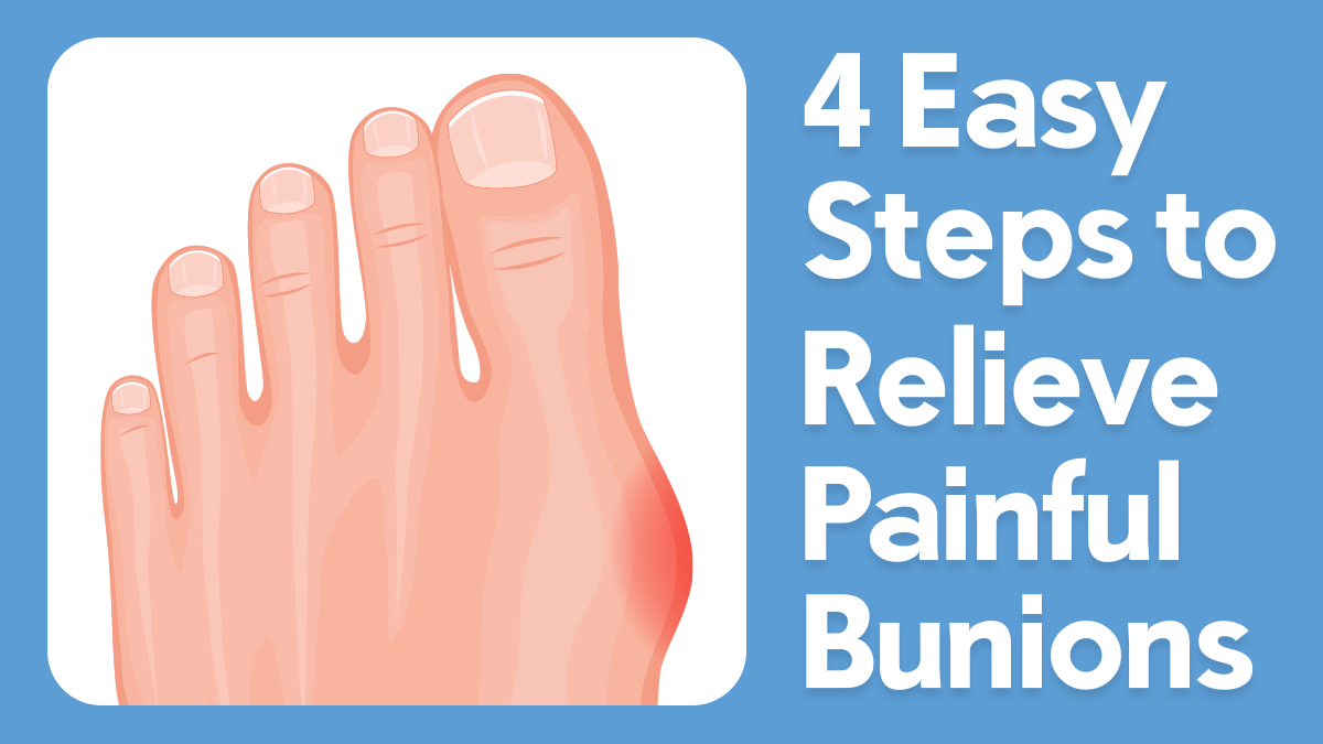 4 Easy Steps to Relieve Painful Bunions