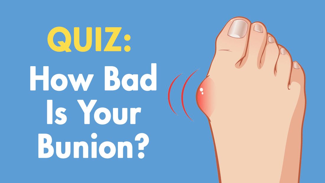 How Bad is Your Bunion? Quiz