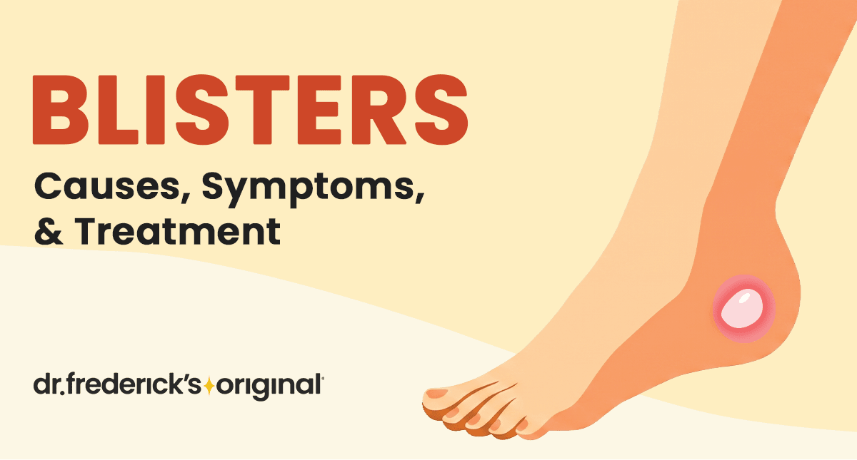 Blisters: Symptoms, Causes, Types and Treatments