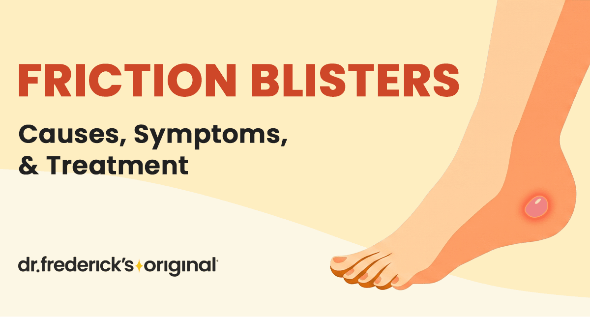 Friction Blisters: Causes, Symptoms and Treatment