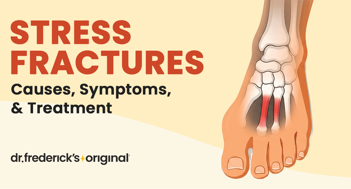 Stress Fractures: Causes, Symptoms and Treatment
