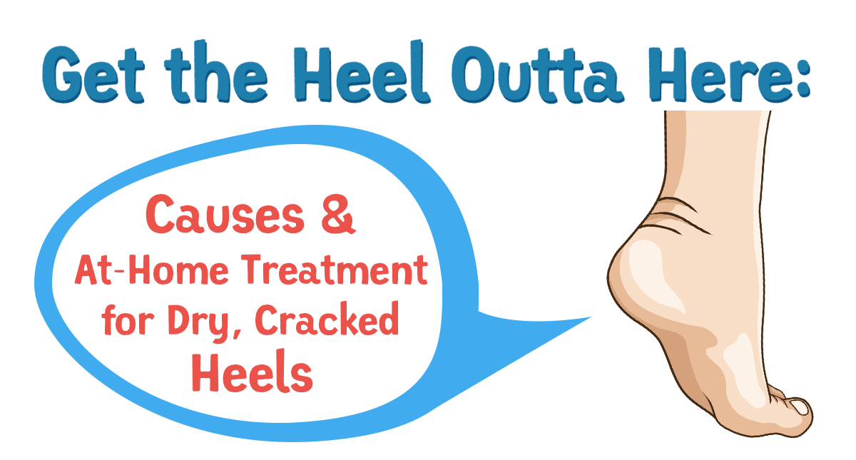 Get the Heel Outta Here: Causes & At-Home Treatment for Dry, Cracked Heels
