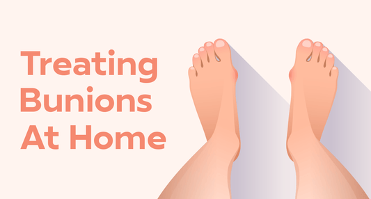 Treating Bunions at Home