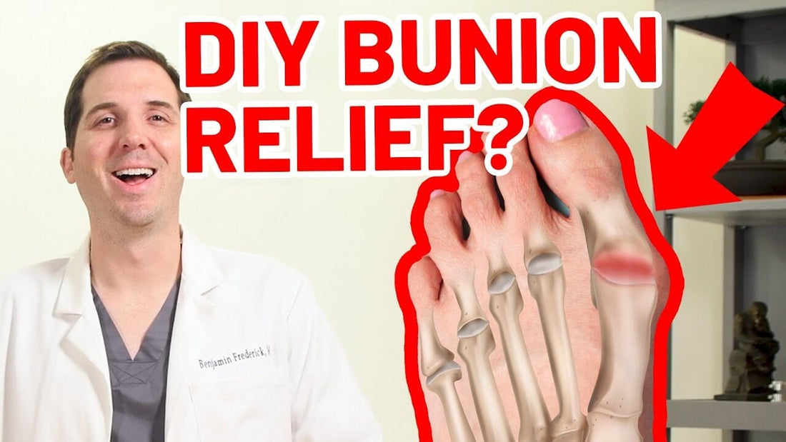 Treating Bunions at Home