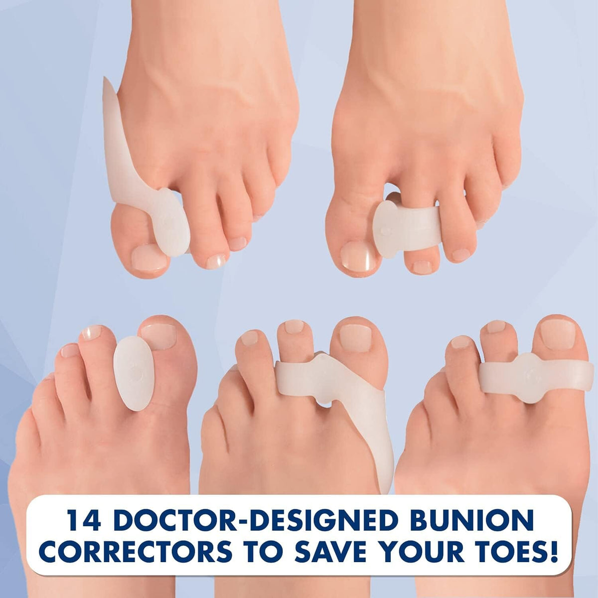 Dr. Frederick&#39;s Original 14-Piece Bunion Corrector Kit - Fast Relief for Bunions &amp; Overlapping Toes - For Men &amp; Women - Soft Gel Pads, Spacers, &amp; Separators - For No Surgery Required Foot Pain Dr. Frederick&#39;s Original 