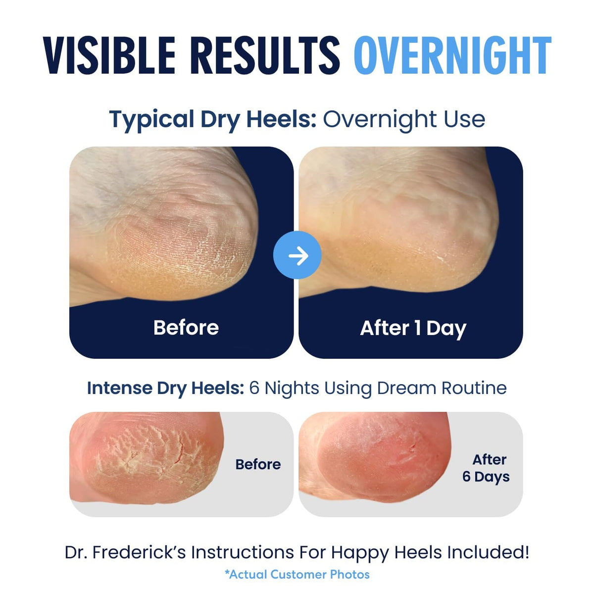 Dr. Frederick&#39;s Original Moisturizing Heel Socks for Cracked Heel Treatment - 2 Pairs - Heel Socks for Dry Cracked Feet - Cracked Heel Repair - Heal Dry Heels - Foot Care for Women &amp; Men - Choose Your Color Cracked Heel Dr. Frederick&#39;s Original 