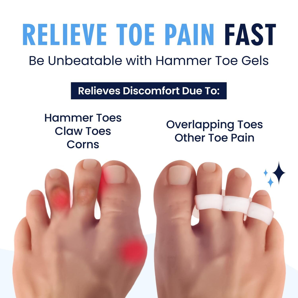 Dr. Frederick&#39;s Original Hammer Toe Gels - 2 Pairs - All-Day Relief for Crooked &amp; Overlapping Toes - Soft Cushioning - Symptomatic Support for Toe Alignment - White - 3 Loop Design Foot Pain Dr. Frederick&#39;s Original 