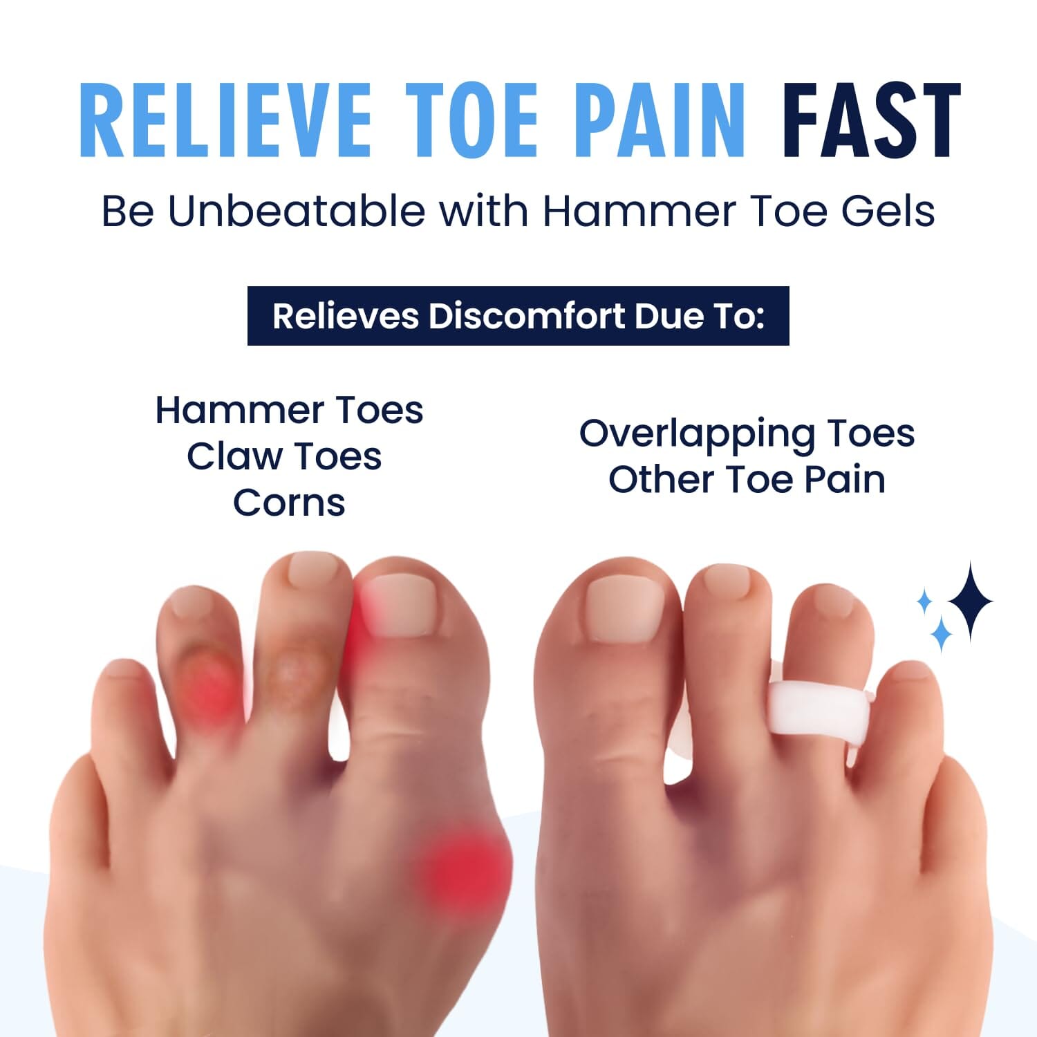 Dr. Frederick's Original Hammer Toe Gels - 2 Pairs - Hammertoe Support Crest for Women & Men - Cushion & Temporary Splint for Toe Alignment, Crooked Toes, and Pain Relief - White - 1 Loop Design Foot Pain Dr. Frederick's Original 
