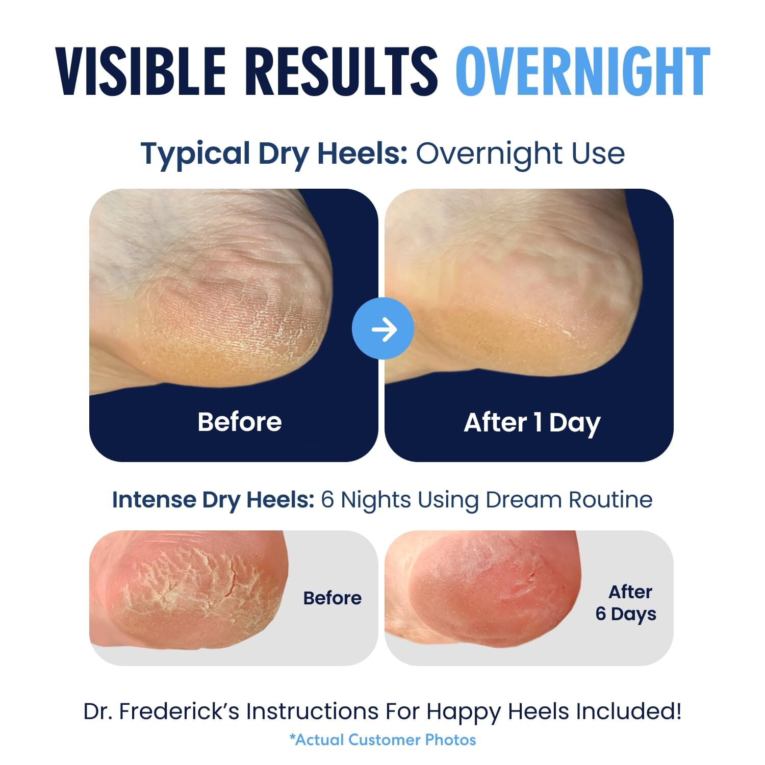 Dr. Frederick's Original Moisturizing Heel Socks for Cracked Heel Treatment - 2 Pairs - Stop Cracked Heels in Their Tracks Cracked Heel Dr. Frederick's Original 