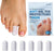 Dr. Frederick's Original Soft Gel Toe Protectors for Men & Women - 6 ct - Toe Caps for Foot Pain Relief - Sleeves for Ingrown Toenails, Corns, Calluses, and Blisters - Small - White Foot Pain Dr. Frederick's Original 