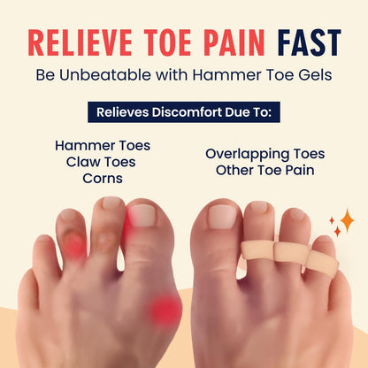 Dr. Frederick's Original Hammer Toe Gels - 2 Pairs - All-Day Relief for Crooked & Overlapping Toes - Soft Cushioning - Symptomatic Support for Toe Alignment - White - 3 Loop Design Toe Care Dr. Frederick's Original 