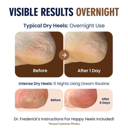 Dr. Frederick's Original Moisturizing Heel Socks for Cracked Heel Treatment - 2 Pairs - Stop Cracked Heels in Their Tracks Cracked Heel Dr. Frederick's Original 