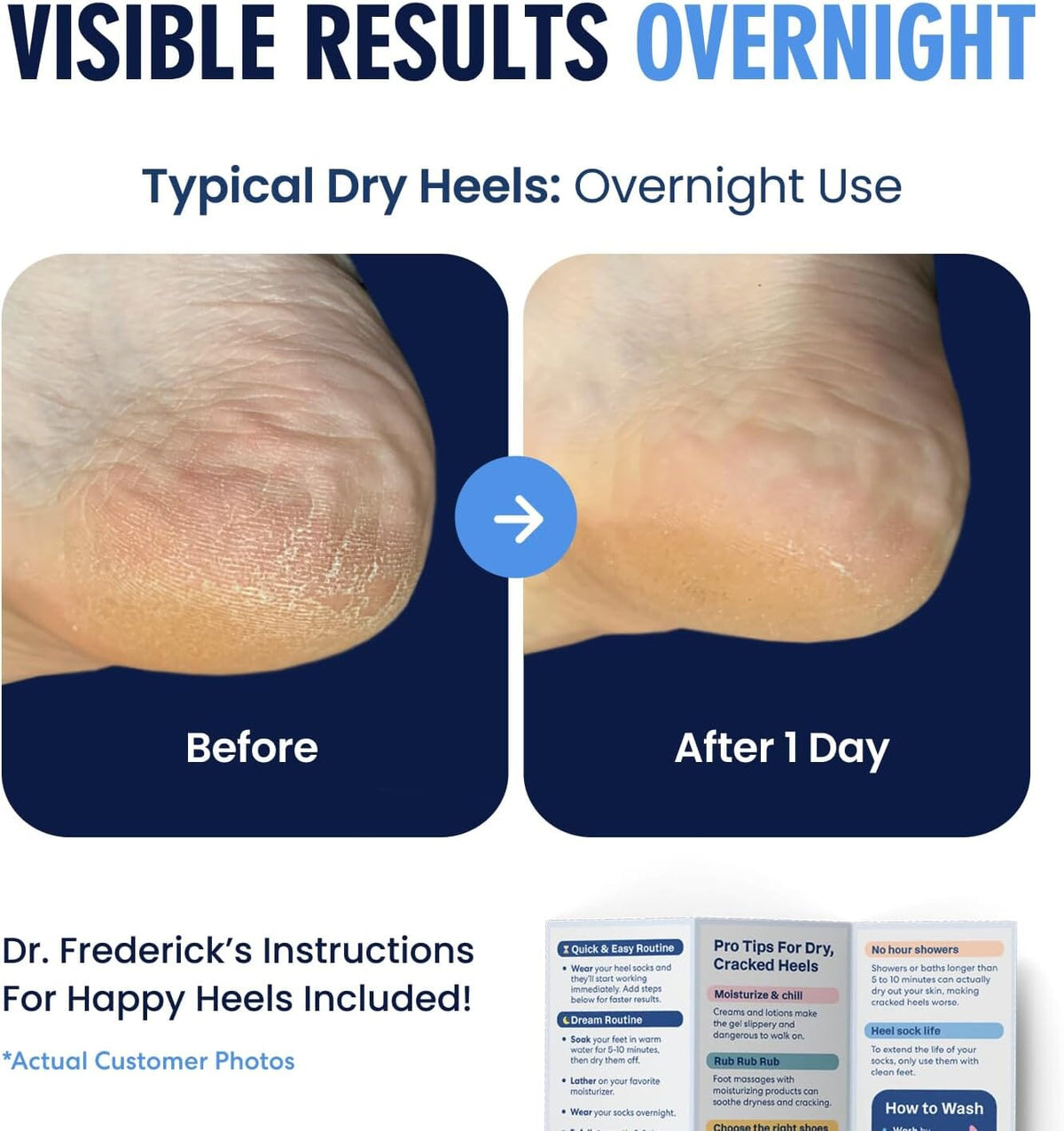 Dr. Frederick&#39;s Original Moisturizing Fuzzy Heel Socks - 2 Pairs - Cozy Gel-Lined Sleep Socks for Women &amp; Men - Soothes Dry, Cracked Feet - Heel Repair - Blue Haven Dr. Frederick&#39;s Original 