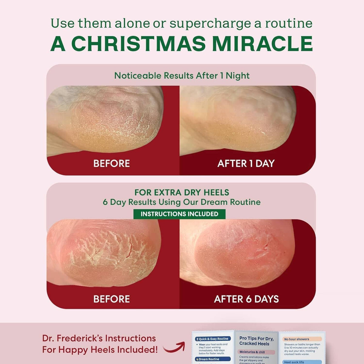 Dr. Frederick&#39;s Original Moisturizing Fuzzy Heel Socks - 3 Pairs - Cozy Gel-Lined Sleep Socks for Women &amp; Men - Soothing Dry, Cracked Feet - Cracked Heel Repair (Holiday Special Edition) Dr. Frederick&#39;s Original 