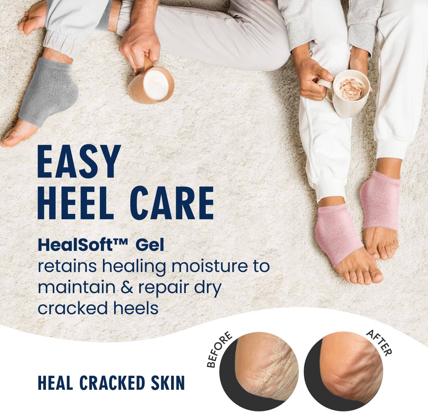 Fuzzy Moisturizing Heel Socks - SootheFast™ Gel - 2 Pairs Moisturizing Therapy Dr. Frederick's Original 