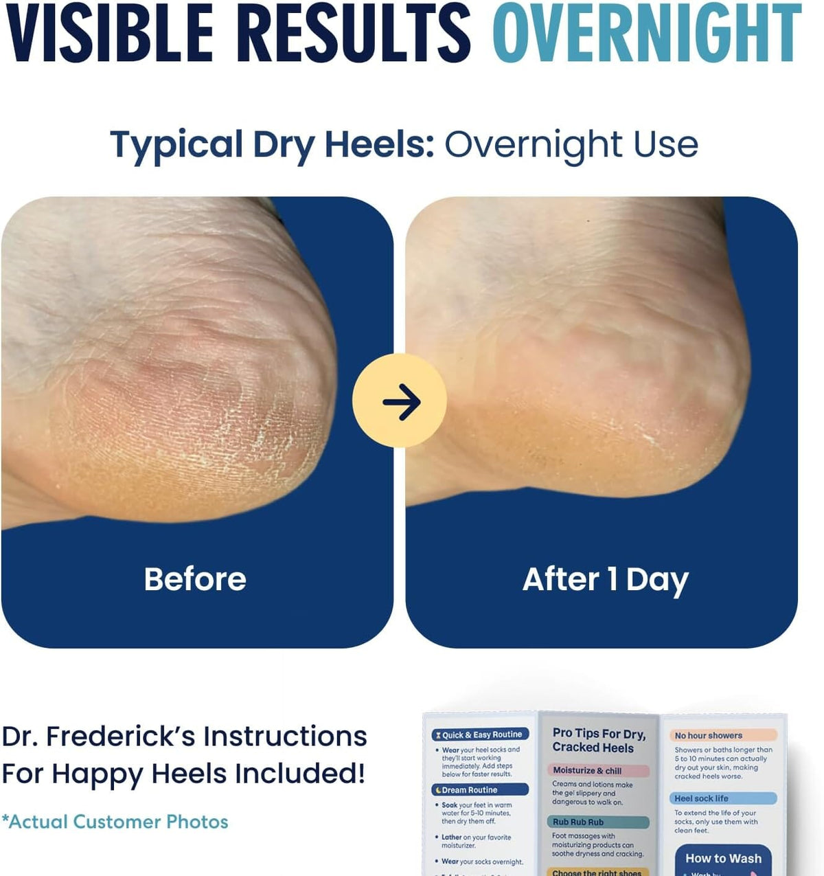 Dr. Frederick&#39;s Original Moisturizing Fuzzy Heel Socks - 2 Pairs - Cozy Gel-Lined Sleep Socks for Women &amp; Men - Soothes Dry, Cracked Feet - Heel Repair - Variety Pack Dr. Frederick&#39;s Original 