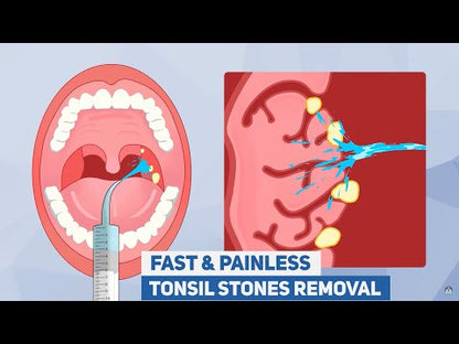 Dr. Frederick's Original Easy Tonsil Stone Remover Kit - Fast Painless Tonsillolith Removal Tool - Fight Bad Breath - Pick and Oral Irrigator - 8 Pieces